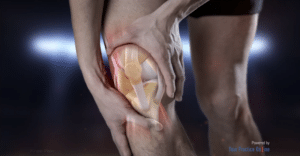Knee Pain animation