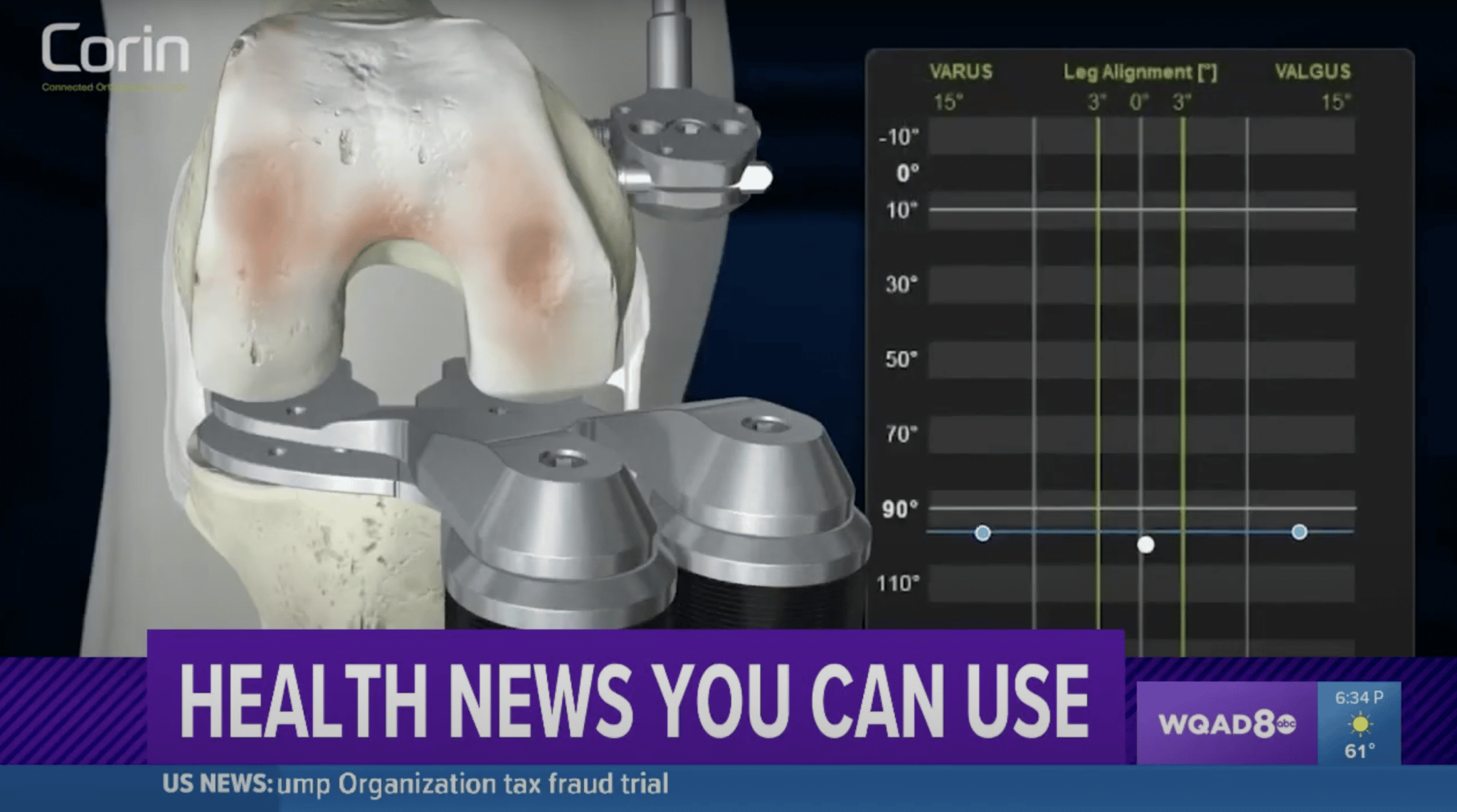 Dr. Jeffrey DeClaire on WQAD 6pm | Balance Bot